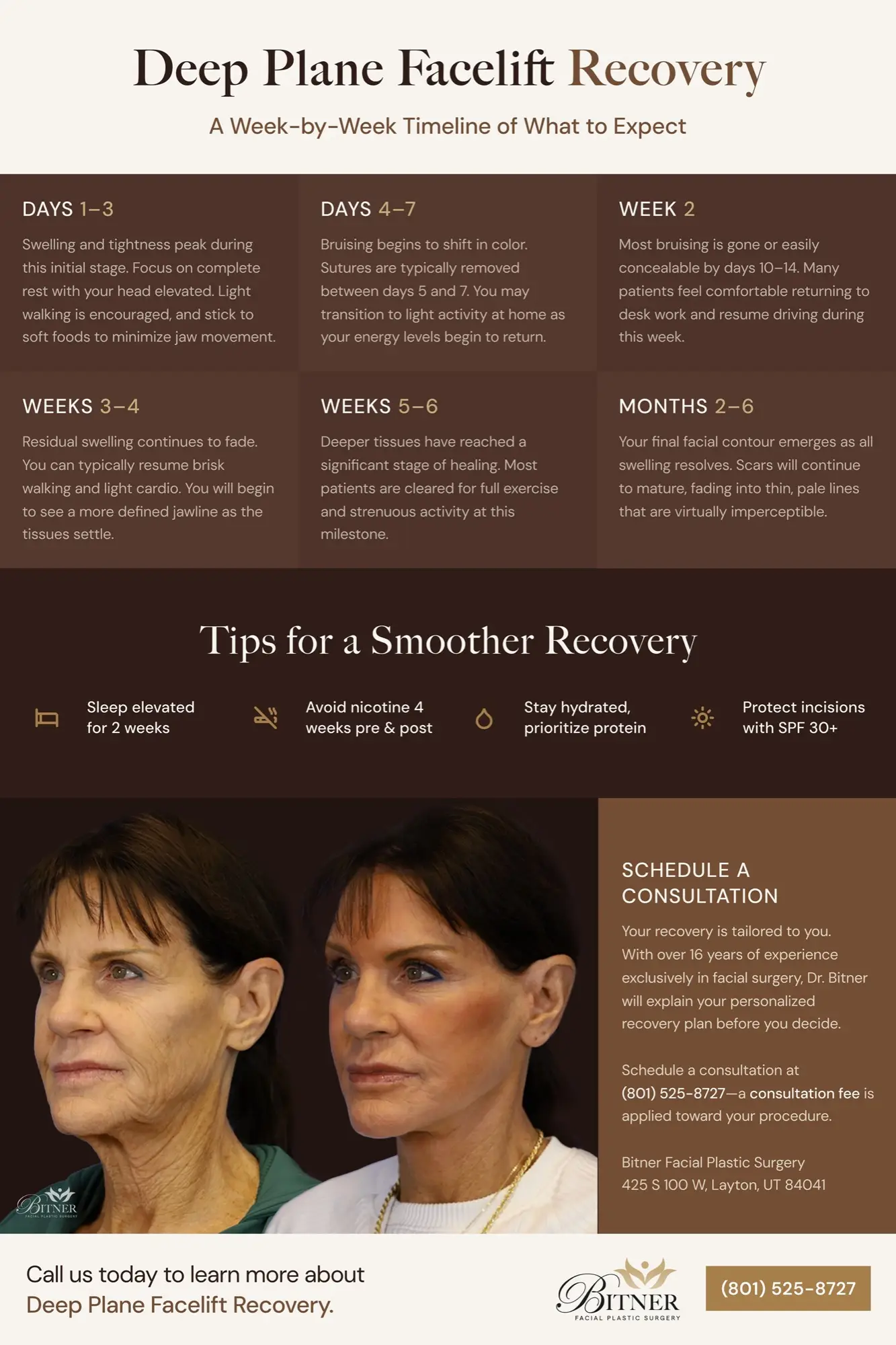 Infographic summarizing deep plane facelift recovery week by week